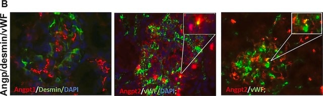 Anti-Desmin Antibody, clone DE-B-5 clone DE-B-5, Chemicon&#174;, from mouse