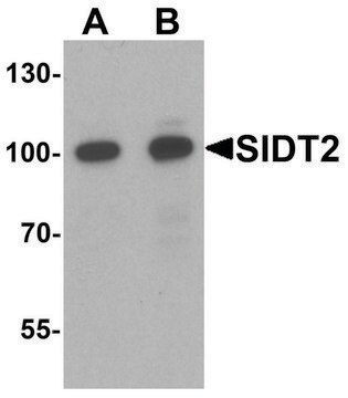 Anti-SIDT2 antibody produced in rabbit affinity isolated antibody, buffered aqueous solution