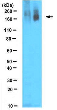 Anti-Poly ADP-ribose Antibody, clone 10H clone 10H, from mouse