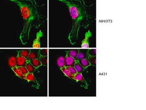 Anti-FOXO4 Antibody from rabbit, purified by affinity chromatography