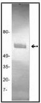 Anti-Tissue Plasminogen Activator (Ab-1) Mouse mAb (GMA-043) liquid, clone GMA-043, Calbiochem&#174;