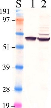 Anti-Retinal Pigment Epithelium 65 Antibody clone 401.8B11.3D9, Chemicon&#174;, from mouse