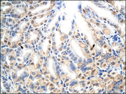 Anti-E2F7 antibody produced in rabbit affinity isolated antibody