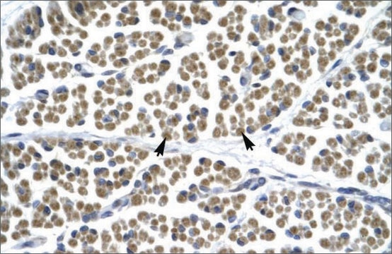 Anti-GABRD antibody produced in rabbit affinity isolated antibody