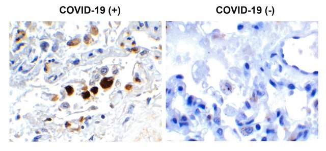 Anti-SARS-CoV-2 (COVID-19) Membrane antibody produced in rabbit affinity isolated antibody