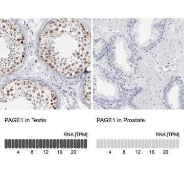 Anti-PAGE1 antibody produced in rabbit Prestige Antibodies&#174; Powered by Atlas Antibodies, affinity isolated antibody, buffered aqueous glycerol solution