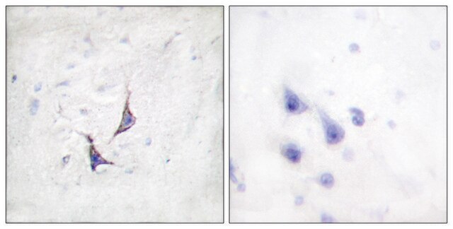 Anti-Syndecan4 antibody produced in rabbit affinity isolated antibody