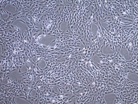 C20A4 Human Chondrocyte Cell Line C20A4 Human Chondrocyte Cell Line is widely used as a model cell line for studying normal and pathological cartilage repair mechanisms related to chondrocyte biology and physiology.