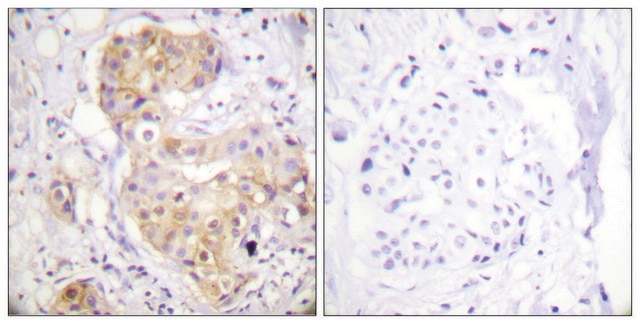 Anti-PKC &#948; antibody produced in rabbit affinity isolated antibody