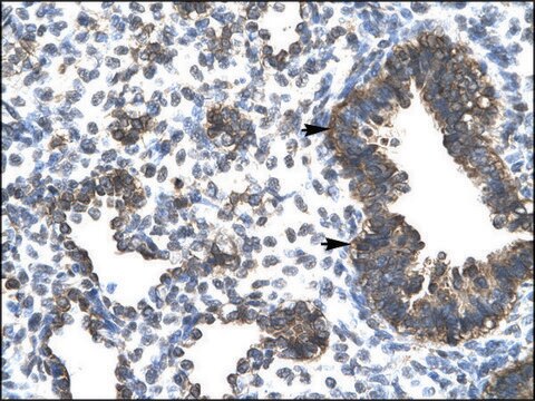 Anti-ESRRG antibody produced in rabbit IgG fraction of antiserum