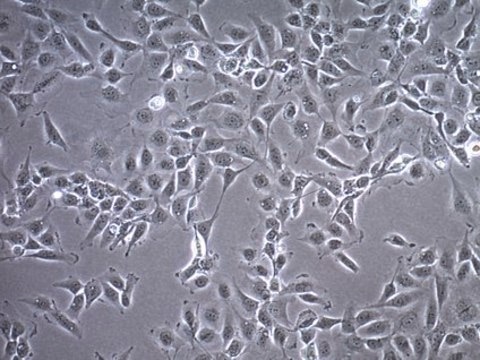 C28/I2 Human Chondrocyte Cell Line C28/I2 Human Chondrocyte Cell Line is widely used as a model cell line for studying normal and pathological cartilage repair mechanisms related to chondrocyte biology and physiology.