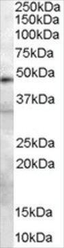 Anti-Plasminogen Activator/PLAU antibody produced in goat affinity isolated antibody, buffered aqueous solution