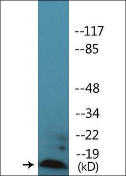 Anti-phospho-Synuclein (pSer129) antibody produced in rabbit affinity isolated antibody