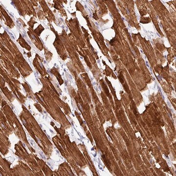 Anti-HBEGF antibody produced in rabbit Prestige Antibodies&#174; Powered by Atlas Antibodies, affinity isolated antibody, buffered aqueous glycerol solution