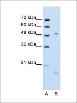 Anti-ITGBL1 (AB1) antibody produced in rabbit IgG fraction of antiserum