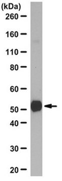 Anti-Properdin Antibody from rabbit, purified by affinity chromatography