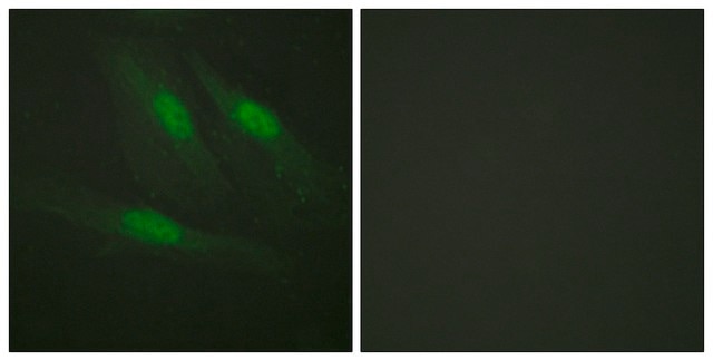 Anti-Catenin-&#946; antibody produced in rabbit affinity isolated antibody