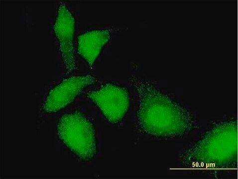 Monoclonal Anti-TKTL1 antibody produced in mouse clone 1C10, purified immunoglobulin, buffered aqueous solution