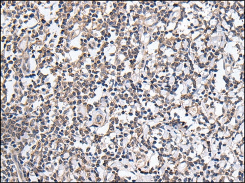 Anti-PLAG1 affinity isolated antibody