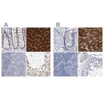 Anti-CTH antibody produced in rabbit Prestige Antibodies&#174; Powered by Atlas Antibodies, affinity isolated antibody, buffered aqueous glycerol solution, Ab2