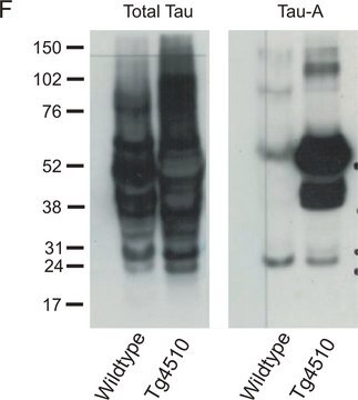 Anti-Tau-1 Antibody, clone PC1C6 clone PC1C6, Chemicon&#174;, from mouse