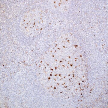 A-1-Antitrypsin Rabbit Polyclonal Antibody