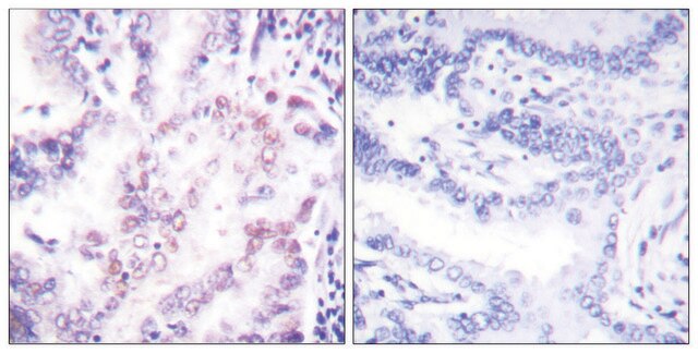 Anti-Thyroid Hormone Receptor &#946;, N-Terminal antibody produced in rabbit affinity isolated antibody