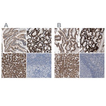 Anti-MARC2 antibody produced in rabbit Prestige Antibodies&#174; Powered by Atlas Antibodies, affinity isolated antibody, buffered aqueous glycerol solution