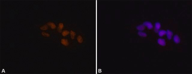 Anti-ADAR1 antibody produced in rabbit ~1.0&#160;mg/mL, affinity isolated antibody