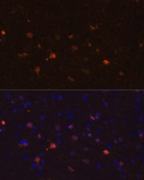 Anti-S100B antibody produced in rabbit