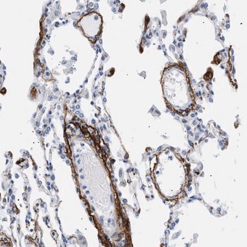 Anti-ELN antibody produced in rabbit Prestige Antibodies&#174; Powered by Atlas Antibodies, affinity isolated antibody, buffered aqueous glycerol solution