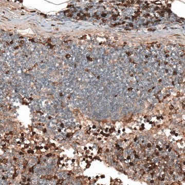 Anti-HJURP antibody produced in rabbit Prestige Antibodies&#174; Powered by Atlas Antibodies, affinity isolated antibody, buffered aqueous glycerol solution