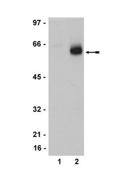 Anti-Estrogen Receptor &#946; Antibody, clone 68-4, rabbit monoclonal clone 68-4, Upstate&#174;, from rabbit