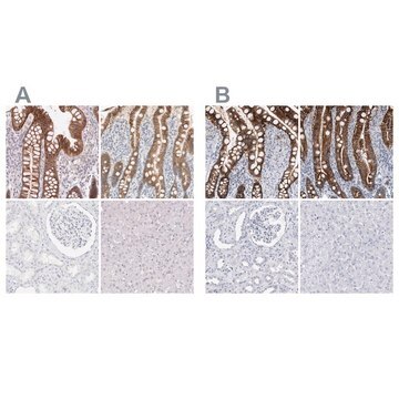 Anti-CDH17 antibody produced in rabbit Prestige Antibodies&#174; Powered by Atlas Antibodies, affinity isolated antibody, buffered aqueous glycerol solution, Ab1