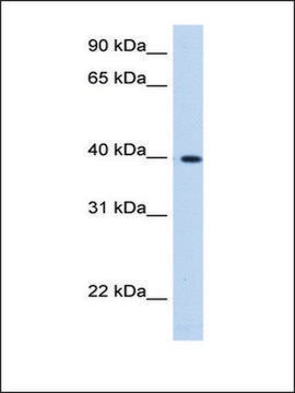 Anti-LIAS antibody produced in rabbit affinity isolated antibody