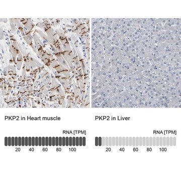 Anti-PKP2 antibody produced in rabbit Prestige Antibodies&#174; Powered by Atlas Antibodies, affinity isolated antibody, buffered aqueous glycerol solution