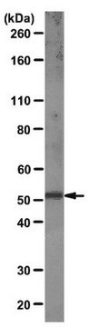 Anti-Retinoid-Related Orphan Receptor &#947; T Antibody, clone RORg2 clone RORg2, from hamster(Armenian)