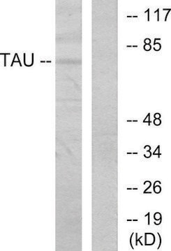 Anti-TAU antibody produced in rabbit affinity isolated antibody