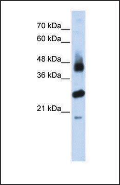 Anti-FBXL2, (N-terminal) antibody produced in rabbit affinity isolated antibody