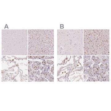 Anti-MRC1 antibody produced in rabbit Prestige Antibodies&#174; Powered by Atlas Antibodies, affinity isolated antibody, buffered aqueous glycerol solution