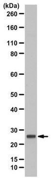 Anti-CCM3/PDCD10 from rabbit, purified by affinity chromatography