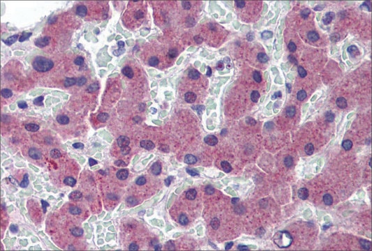 Anti-TFR2 (ab2) antibody produced in rabbit affinity isolated antibody