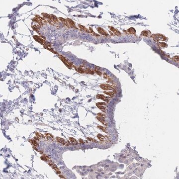 Anti-SLC7A6 antibody produced in rabbit Prestige Antibodies&#174; Powered by Atlas Antibodies, affinity isolated antibody, buffered aqueous glycerol solution