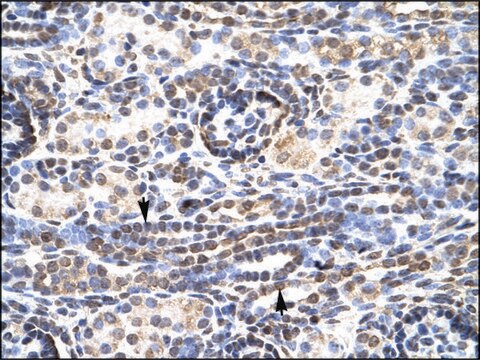 Anti-KLF9 antibody produced in rabbit affinity isolated antibody