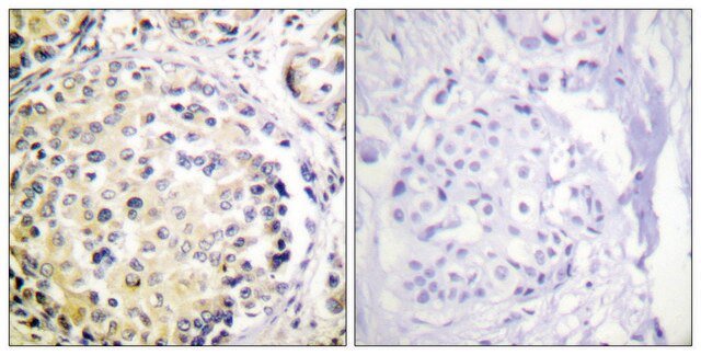 Anti-Vimentin antibody produced in rabbit affinity isolated antibody