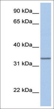 Anti-SPDEF (AB1) antibody produced in rabbit affinity isolated antibody