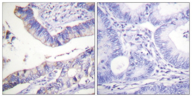 Anti-BCL-2 antibody produced in rabbit affinity isolated antibody