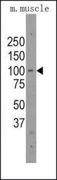 Anti-PARP12 (C-term) antibody produced in rabbit saturated ammonium sulfate (SAS) precipitated, buffered aqueous solution