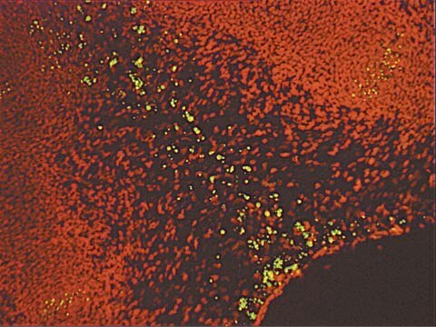 ApopTag Plus In Situ Apoptosis Fluorescein Detection Kit The ApopTag Plus Fluorescein In Situ Apoptosis Detection Kit detects apoptotic cells in situ by the indirect TUNEL method, utilizing an anti-digoxigenin antibody that is conjugated to a fluorescein reporter molecule.