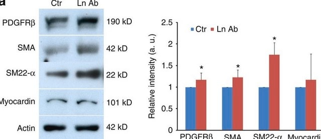 Anti-Actin, &#945;-Smooth Muscle - FITC antibody, Mouse monoclonal clone 1A4, purified from hybridoma cell culture